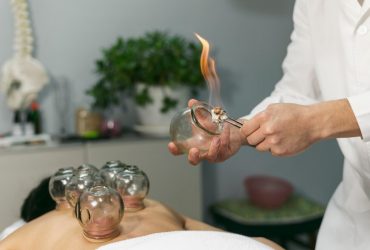 بهترین زمان برای حجامت