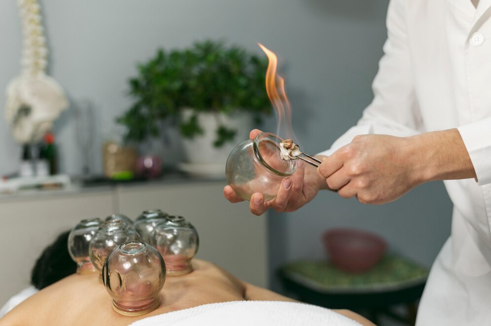 بهترین زمان برای حجامت